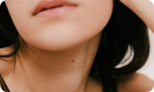 Clear skin showing positive diet and hormone changes