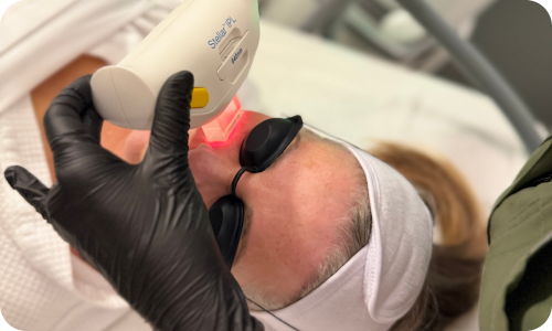 Patient on table with eye protection